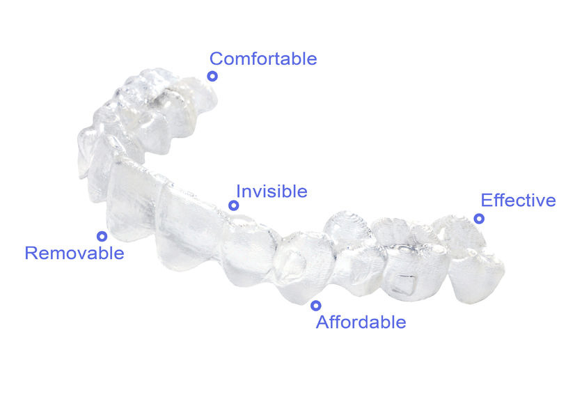 How Invisalign Works