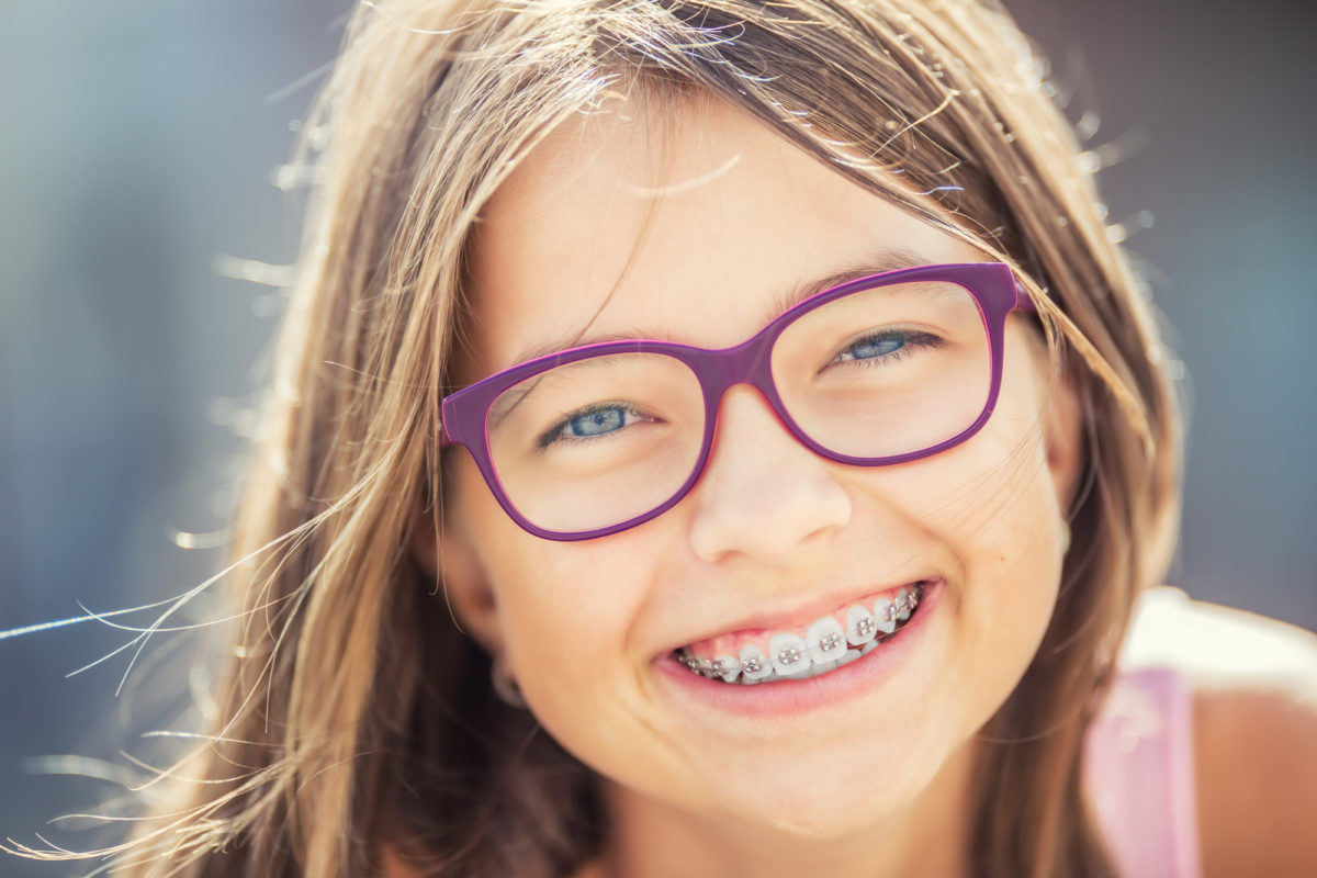 Understanding the Different Types of Braces Orthodontists Use Today
