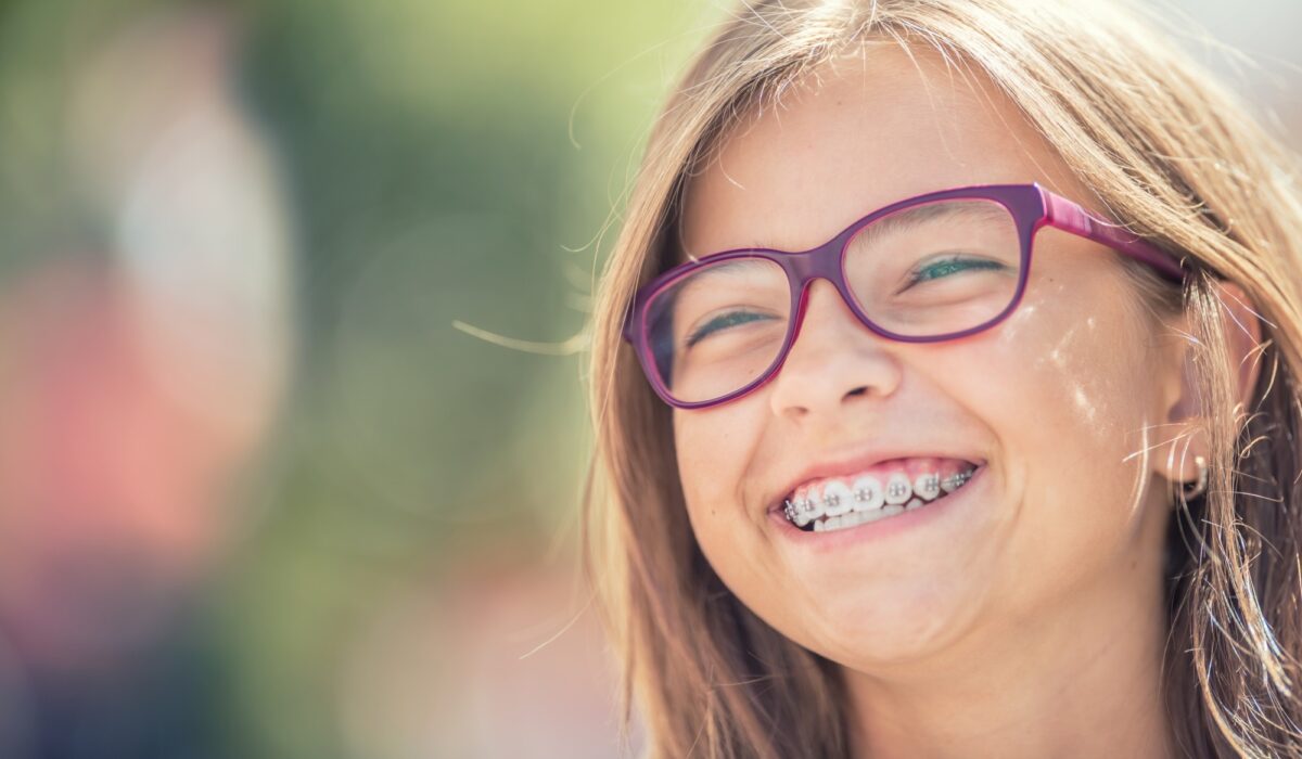 Everything You Need To Know About Children’s Braces
