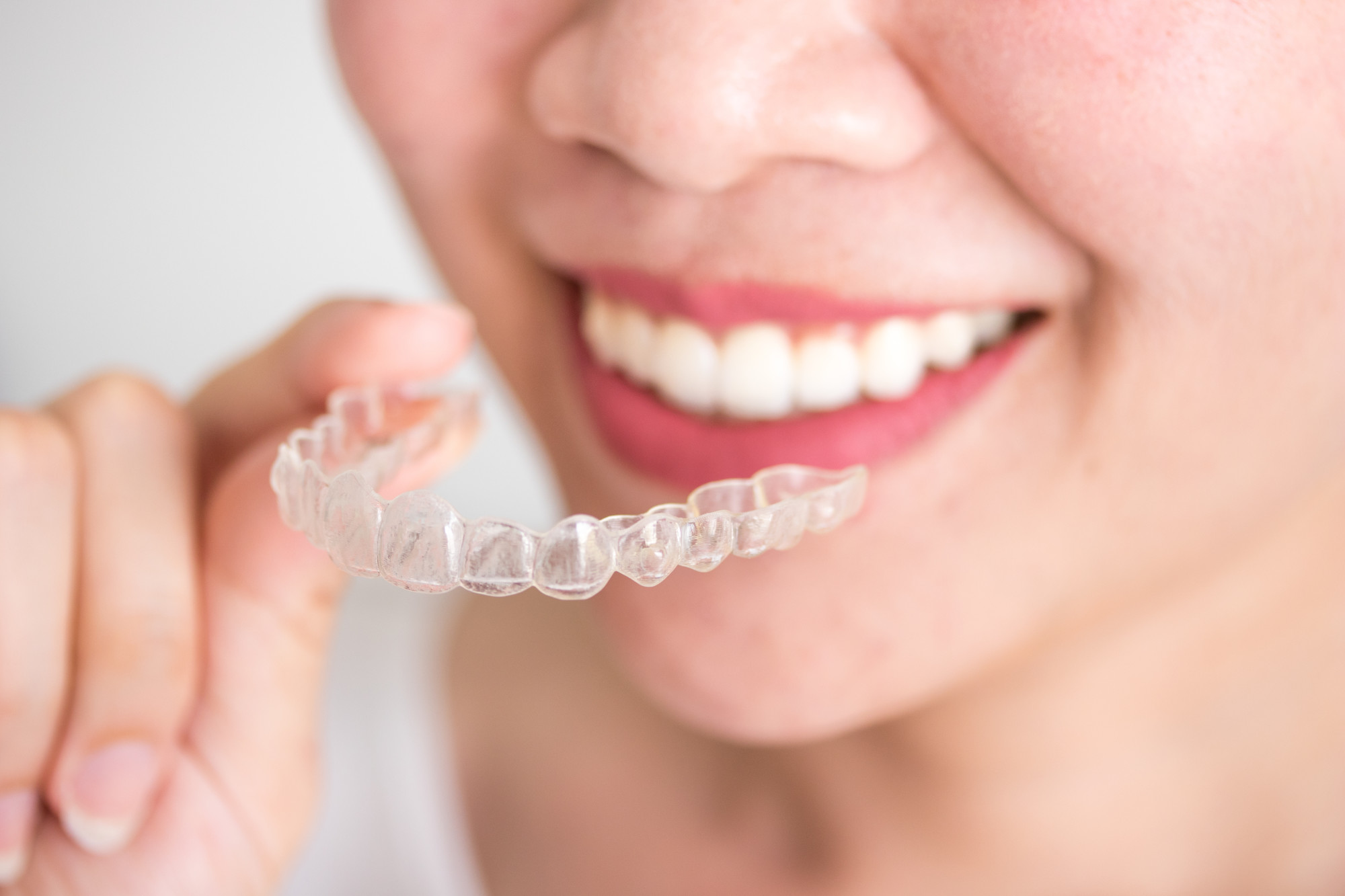 Invisible braces cost