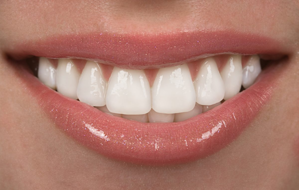 Your Guide to Ceramic Braces