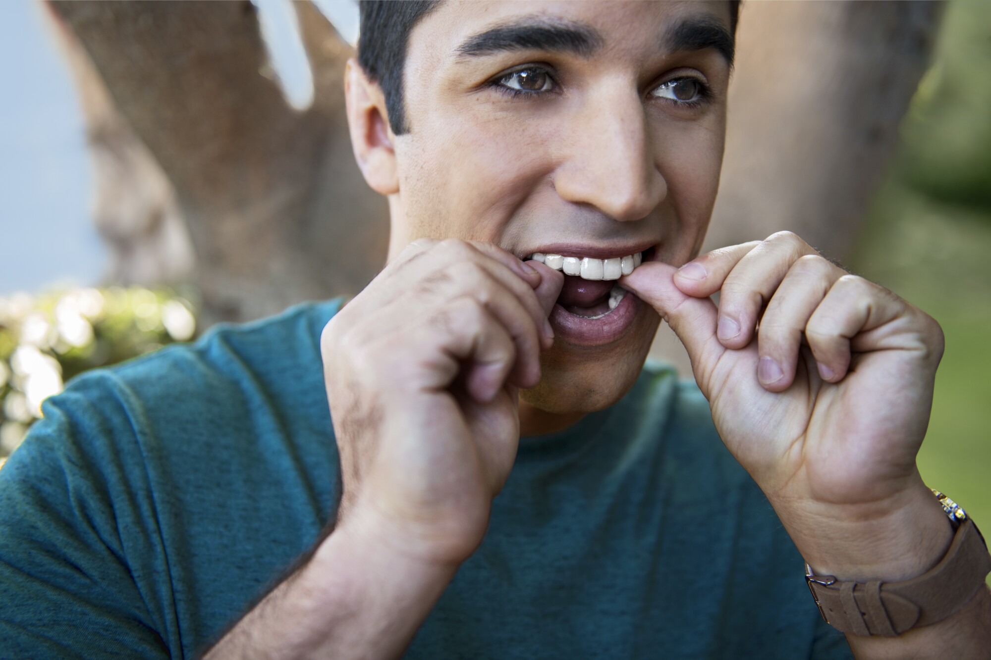 Teeth and Timelines: How Long Does an Invisalign Treatment Take?